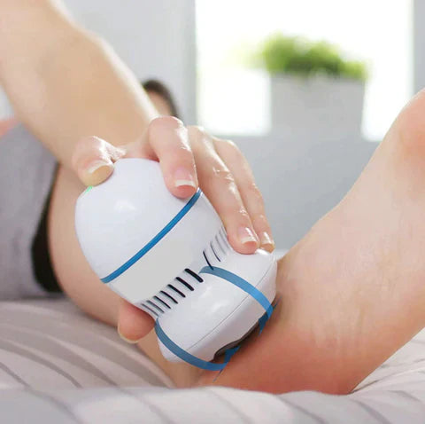 Electric Vacuum Callus Remover, product image 1